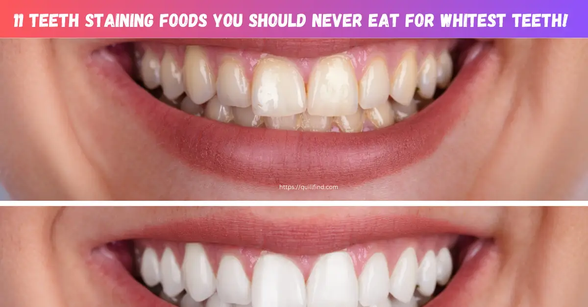 11 Teeth Staining Foods You Should NEVER Eat for whitest teeth!